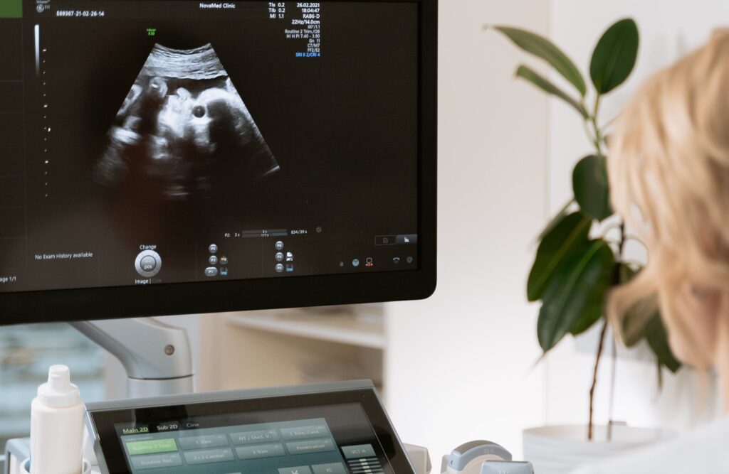 woman looking at ultrasound representing Prenatal fentanyl exposure

